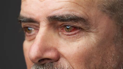 alluc bloodshot|Bloodshot .